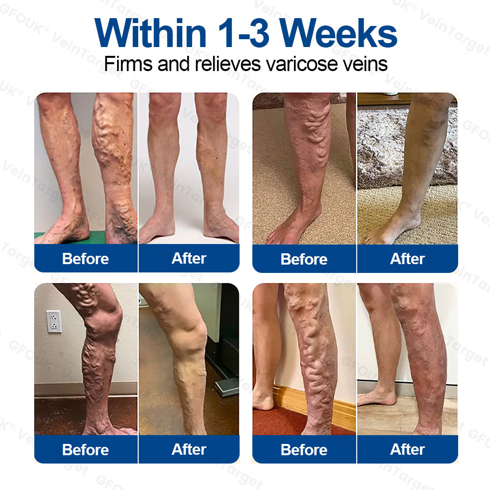✨8 boxes - Completely repair and strengthen blood vessels - £5.7 / box