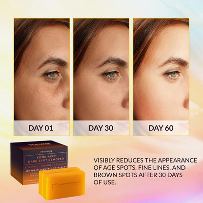 Pheromex Kojic Acid Dark Spot Remover Soap Bars with Vitamin C, Retinol, Collagen, Turmeric - Original Japanese Complex Infused with Hyaluronic Acid, Vitamin E, Shea Butter, Castile Olive Oil