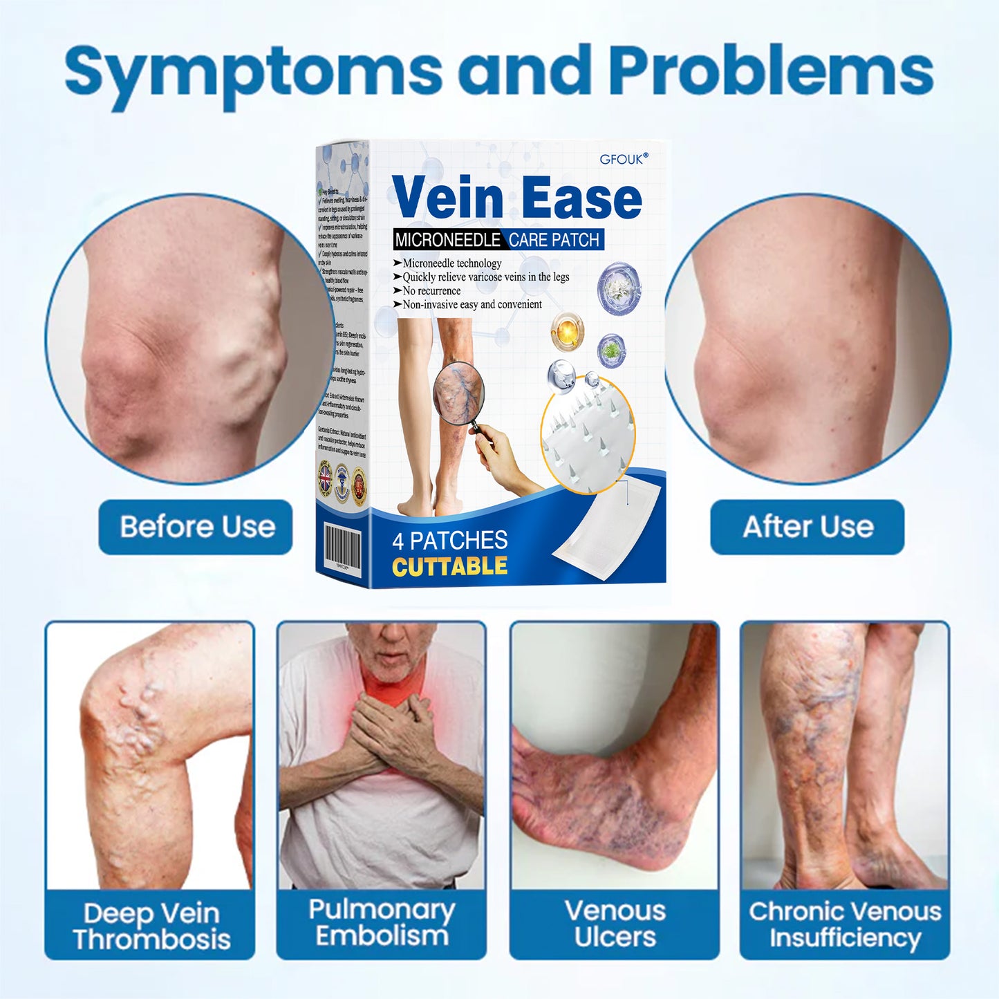 🇬🇧🌿GFOUК® VeinEase Microneedle Care Patch⚡Instant Relief, Long-Term Results